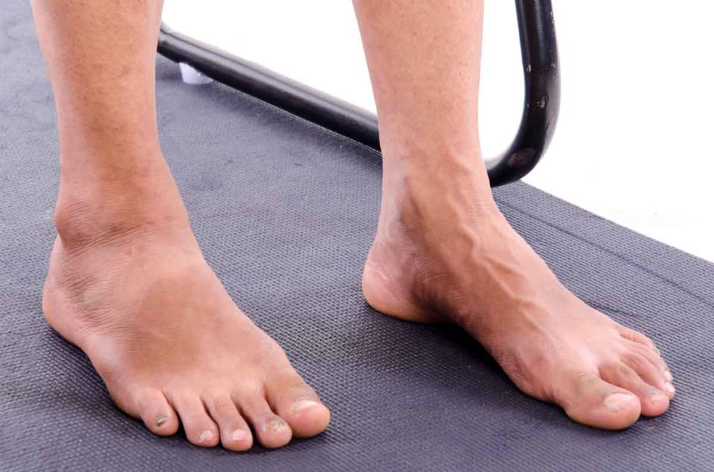 Great Toe Extension