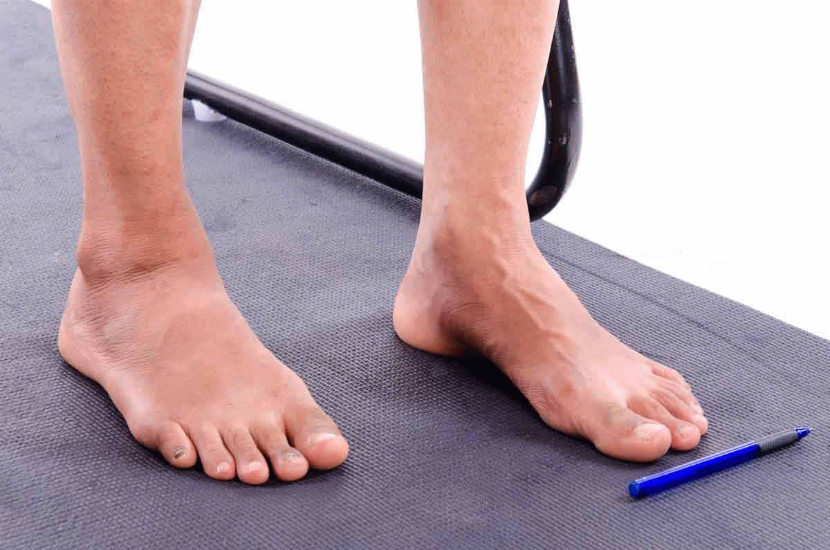 Pen Lift with Toes Vissco Healthcare Private Limited.